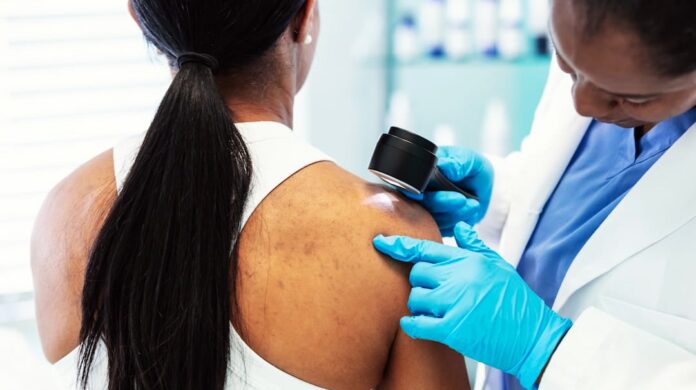 WhatsApp Image 2026-09-03 at 5.00.04 AM Melanoma Treatment UK: A Guide to Care Options